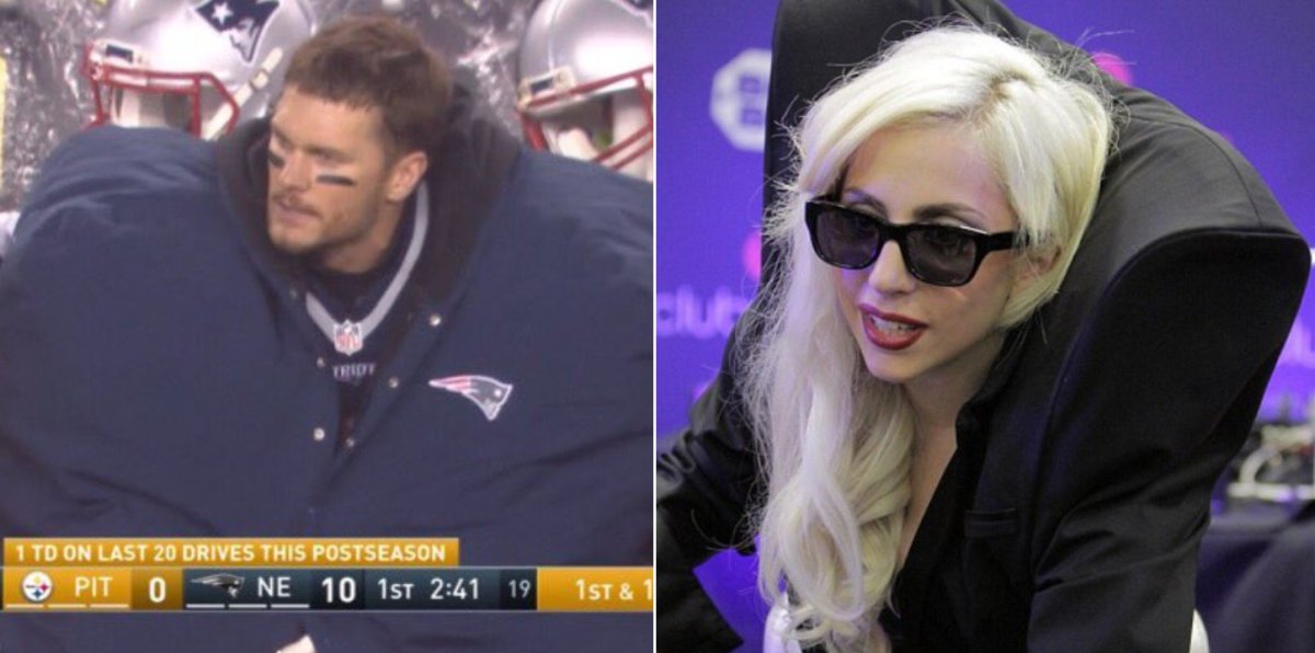Tom Brady viral chaqueta