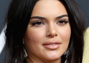 “No dejes que esta mierda te pare”. Kendall Jenner zanja el debate sobre su acné