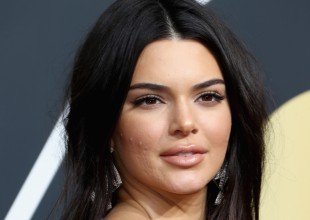 No solo Kendall Jenner, muchas otras celebs reivindican sus granos
