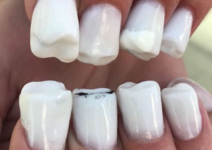 Ya es posible tener dientes en tus uñas