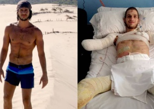 La increíble historia de Davide Morana, el joven que perdió los brazos y las piernas